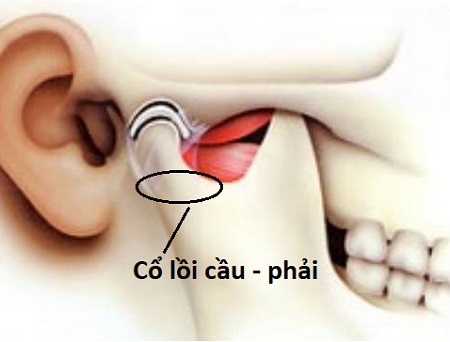 Có những loại xương khớp nào thường cần nắn chỉnh?
